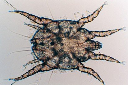 Ear mite under microscope
